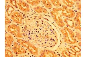 IHC image of ABIN7163572 diluted at 1:400 and staining in paraffin-embedded human kidney tissue performed on a Leica BondTM system.