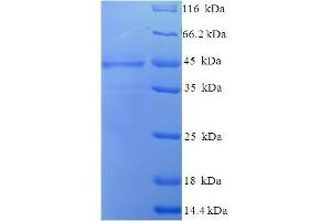 SDS-PAGE (SDS) image for Collectin Sub-Family Member 10 (C-Type Lectin) (COLEC10) (AA 28-277) protein (His-SUMO Tag) (ABIN5711989)