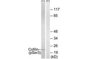 Western blot analysis of extracts from NIH-3T3 cells treated with paclitaxel 1uM 24hours, using Cofilin (Phospho-Ser3) Antibody. (Cofilin anticorps  (pSer3))