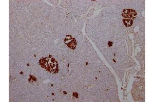 IHC image of ABIN7127574 diluted at 1:100 and staining in paraffin-embedded human pancreatic tissue performed on a Leica BondTM system.