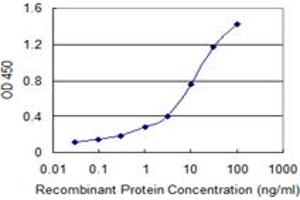 Detection limit for recombinant GST tagged SP100 is 0. (SP100 anticorps  (AA 1-98))