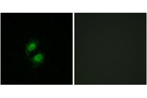 Immunofluorescence analysis of A549 cells, using ZNF95 Antibody. (ZNF95 anticorps  (AA 291-340))