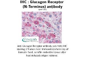 Image no. 1 for anti-Glucagon Receptor (GCGR) (Extracellular Domain), (N-Term) antibody (ABIN1734753) (Glucagon Receptor anticorps  (Extracellular Domain, N-Term))