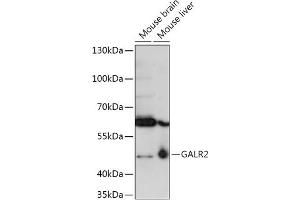 Western blot analysis of extracts of various cell lines, using G antibody (ABIN7267335) at 1:1000 dilution. (GALR2 anticorps  (AA 50-150))