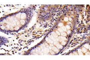 Detection of HMGCR in Porcine Colon Tissue using Polyclonal Antibody to 3-Hydroxy-3-Methylglutaryl Coenzyme A Reductase (HMGCR)