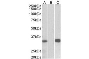 Western Blotting (WB) image for anti-Kv Channel Interacting Protein 3, Calsenilin (KCNIP3) (Internal Region) antibody (ABIN1105646) (DREAM anticorps  (Internal Region))