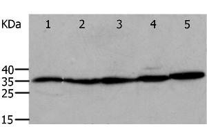 Western Blot analysis of Mouse eyes and heart, Human cervical cancer tissue, OP9 and RAW264. (Annexin V anticorps)