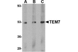 Western blot analysis of TEM7 in human liver tissue lysate with this product at (A) 0. (PLXDC1 anticorps  (C-Term))