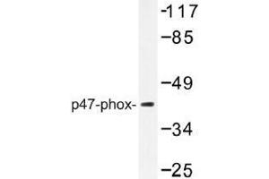Image no. 1 for anti-Neutrophil Cytosol Factor 1 (NCF1) antibody (ABIN317896) (NCF1 anticorps)