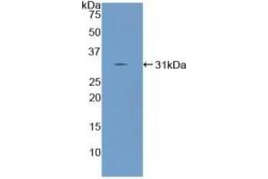 Detection of Recombinant ANGPTL2, Mouse using Polyclonal Antibody to Angiopoietin Like Protein 2 (ANGPTL2)