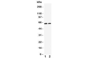 Western blot testing of OCT1 antibody and Lane 1:  HeLa (SLC22A1 anticorps  (C-Term))