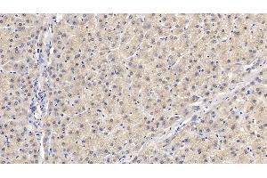 Detection of SMAD3 in Human Liver Tissue using Monoclonal Antibody to SMAD family member 3 (SMAD3)