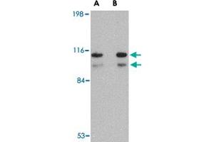 Western blot analysis of SATB1 in SK-N-SH cell lysate with SATB1 polyclonal antibody  at (A) 1 and (B) 2 ug/mL . (SATB1 anticorps  (N-Term))