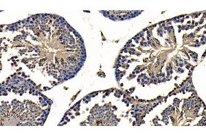 Detection of TRAF6 in Mouse Testis Tissue using Polyclonal Antibody to TNF Receptor Associated Factor 6 (TRAF6)