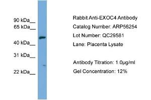 WB Suggested Anti-EXOC4  Antibody Titration: 0. (Sec8 anticorps  (N-Term))
