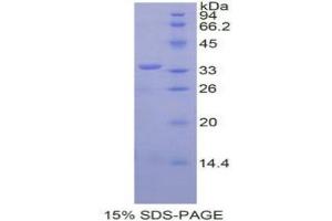 SDS-PAGE analysis of Mouse SPINK5 Protein. (SPINK5 Protéine)