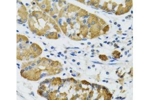 Immunohistochemistry of paraffin-embedded Human stomach using PLA2G2D Polyclonal Antibody at dilution of 1:100 (40x lens).