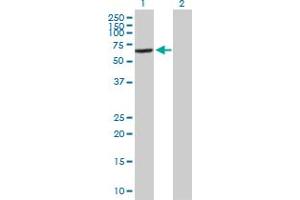 Western Blot analysis of VPS45 expression in transfected 293T cell line by VPS45 MaxPab polyclonal antibody. (VPS45 anticorps  (AA 1-570))