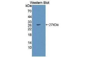Western blot analysis of the recombinant protein. (PEX1 anticorps  (AA 172-377))