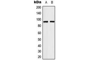 Western blot analysis of TCEB3 expression in HeLa (A), Jurkat (B) whole cell lysates. (TCEB3 anticorps  (Center))