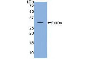 Detection of Recombinant DEP1, Human using Polyclonal Antibody to Density Enhanced Phosphatase 1 (DEP1) (PTPRJ anticorps  (AA 1061-1293))