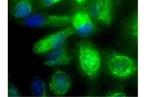 Immunofluorescence (Cultured Cells) (IF (cc)) image for anti-Vimentin (VIM) (AA 371-466) antibody (ABIN672786)