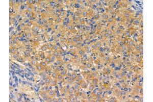 ABIN6257923 and ABIN6274887 at 1/100 staining Rat ovarian tissue by IHC-P.