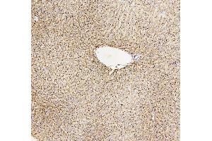 IHC analysis of GUSB using anti-GUSB antibody (ABIN7599854).