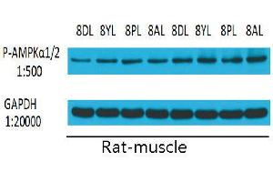 Western Blot (WB) analysis: Please contact us for more details. (PRKAA1/PRKAA2 anticorps  (pThr172, pThr183))