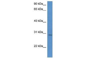 Western Blot showing UTP23 antibody used at a concentration of 1-2 ug/ml to detect its target protein. (UTP23 anticorps  (C-Term))