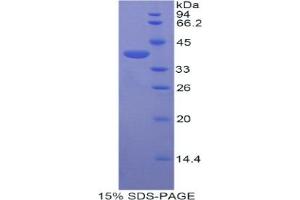 SDS-PAGE analysis of Mouse Centaurin alpha 2 Protein. (ADAP2 Protéine)