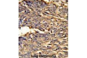 Immunohistochemistry (IHC) image for anti-Hemoglobin, alpha 2 (HBa2) antibody (ABIN2932211)