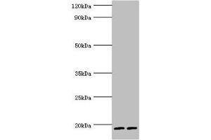 Western blot All lanes: Serglycin antibody at 9 μg/mL Lane 1: THP-1 whole cell lysate Lane 2: HL60 whole cell lysate Secondary Goat polyclonal to rabbit IgG at 1/10000 dilution Predicted band size: 18 kDa Observed band size: 18 kDa (SRGN anticorps  (AA 28-158))
