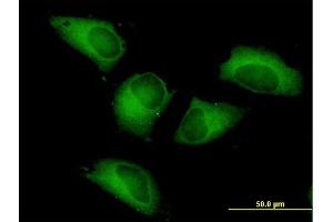 Immunofluorescence of purified MaxPab antibody to PFKP on HeLa cell.