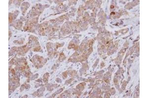 Image no. 2 for anti-Rho Guanine Nucleotide Exchange Factor 25 (ARHGEF25) (AA 226-446) antibody (ABIN1496711)