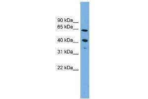 WB Suggested Anti-ATP8B2 Antibody Titration:  0.