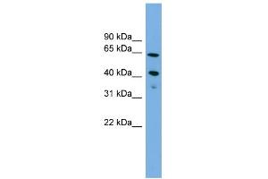WB Suggested Anti-ATP8B2 Antibody Titration:  0. (ATP8B2 anticorps  (N-Term))