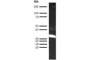 Western Blotting (WB) image for anti-alpha 1 Microglobulin/bikunin precursor (AMBP) antibody (ABIN613729) (AMBP anticorps)