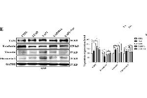 TEAD is involved in YAP1-induced EMT in A549 cells. (GAPDH anticorps)