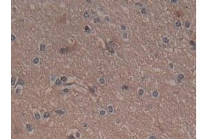 Detection of GARS in Human Cerebrum Tissue using Polyclonal Antibody to Glycyl tRNA Synthetase (GARS)