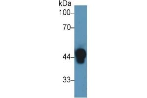 Rabbit Detection antibody from the kit in WB with Positive Control: Sample Human serum.