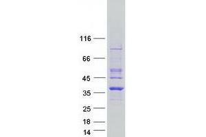 Validation with Western Blot