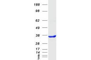Validation with Western Blot