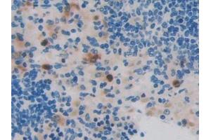 Detection of RNASE3 in Rat Spleen Tissue using Polyclonal Antibody to Ribonuclease A3 (RNASE3)