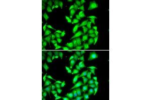 Immunofluorescence analysis of HeLa cells using PPM1A antibody. (PPM1A anticorps  (AA 1-382))