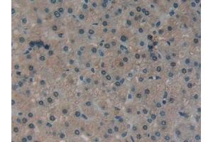 Detection of ATXN1 in Human Liver Tissue using Polyclonal Antibody to Ataxin 1 (ATXN1)