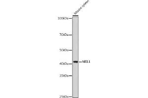 Western blot analysis of extracts of Mouse spleen, using NEIL1 antibody (ABIN6130579, ABIN6144514, ABIN6144515 and ABIN6221523) at 1:1000 dilution.