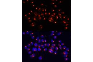 Immunofluorescence analysis of 293T cells using AARS antibody (ABIN7265526) at dilution of 1:100 (40x lens).
