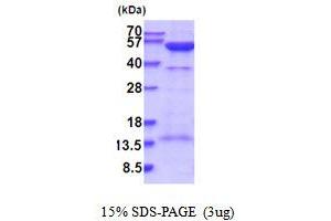 SDS-PAGE (SDS) image for Protein Kinase, CAMP-Dependent, Regulatory, Type II, alpha (PRKAR2A) (AA 1-404) protein (His tag) (ABIN5854185)