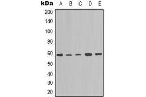 Western blot analysis of NOTCH4 expression in A549 (A), K562 (B), Hela (C), mouse brain (D), NIH3T3 (E) whole cell lysates. (NOTCH4 anticorps  (C-Term))